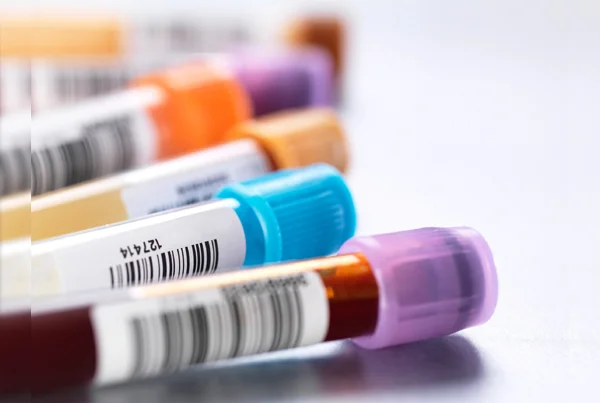 All lab tests including blood test